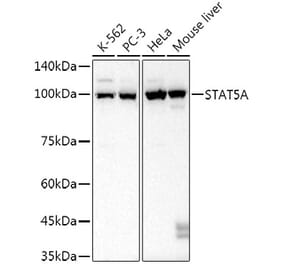 Western Blot - Anti-STAT5 Antibody [ARC52814] (A306906) - Antibodies.com