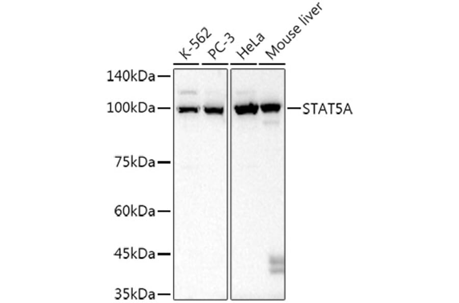 Western Blot - Anti-STAT5 Antibody [ARC52814] (A306906) - Antibodies.com
