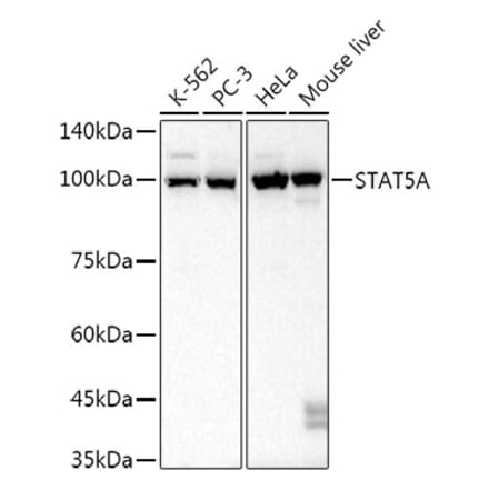 Western Blot - Anti-STAT5 Antibody [ARC52814] (A306906) - Antibodies.com