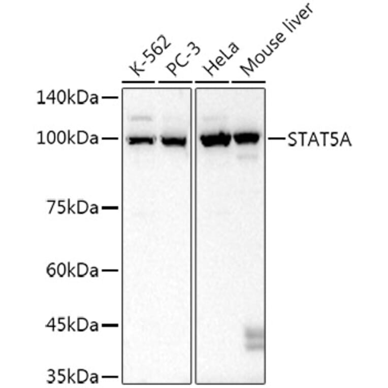 Western Blot - Anti-STAT5 Antibody [ARC52814] (A306906) - Antibodies.com