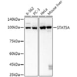 Western Blot - Anti-STAT5 Antibody [ARC52814] (A306906) - Antibodies.com