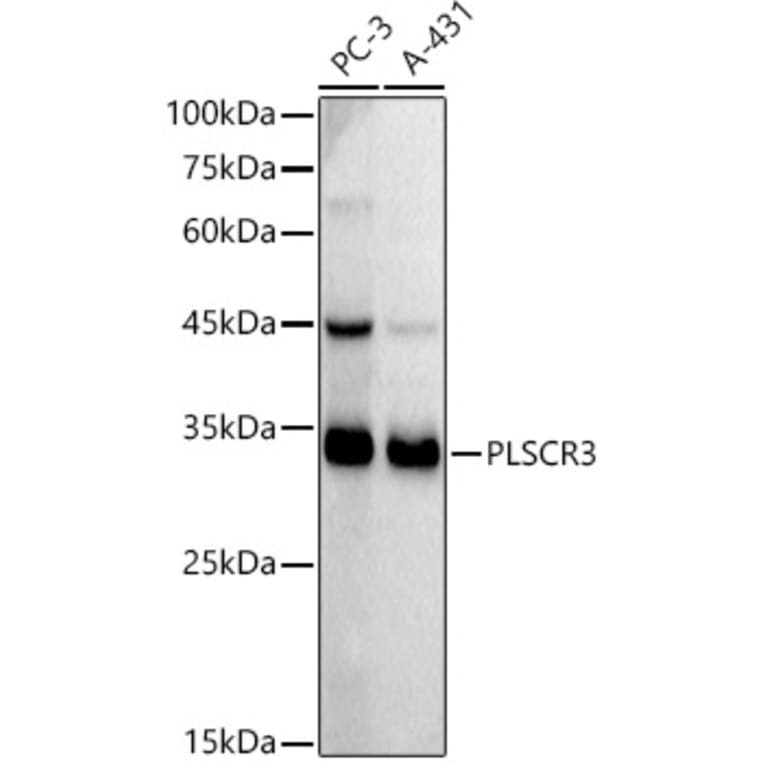 Western Blot - Anti-PLSCR3 Antibody [ARC2887] (A306907) - Antibodies.com