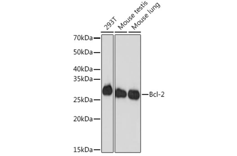 Western Blot - Anti-Bcl-2 Antibody [ARC0173] (A306910) - Antibodies.com