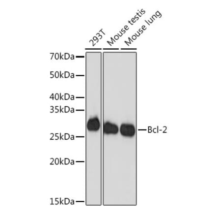 Western Blot - Anti-Bcl-2 Antibody [ARC0173] (A306910) - Antibodies.com