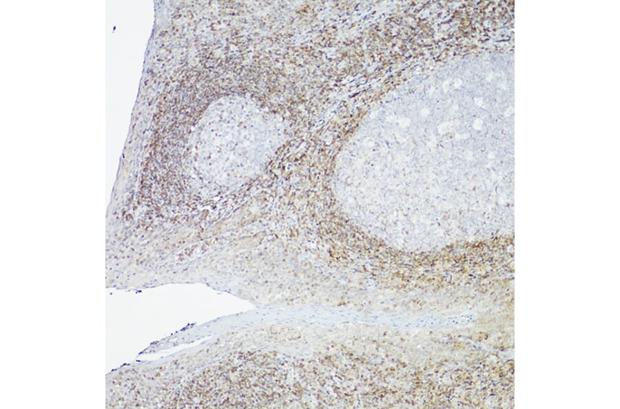 Immunohistochemistry - Anti-Bcl-2 Antibody [ARC0173] (A306910) - Antibodies.com