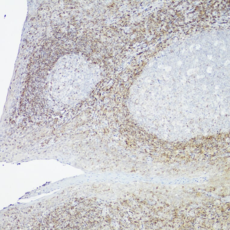 Immunohistochemistry - Anti-Bcl-2 Antibody [ARC0173] (A306910) - Antibodies.com