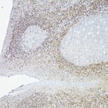 Immunohistochemistry - Anti-Bcl-2 Antibody [ARC0173] (A306910) - Antibodies.com