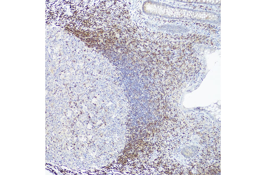 Immunohistochemistry - Anti-Bcl-2 Antibody [ARC0173] (A306910) - Antibodies.com