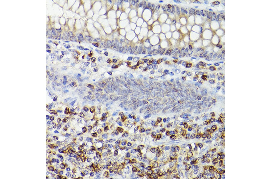Immunohistochemistry - Anti-Bcl-2 Antibody [ARC0173] (A306910) - Antibodies.com