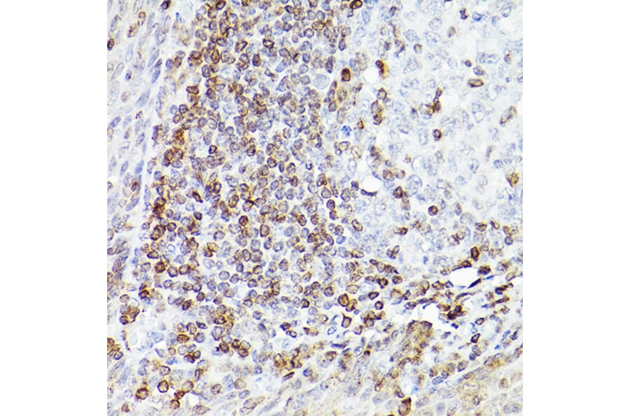 Immunohistochemistry - Anti-Bcl-2 Antibody [ARC0173] (A306910) - Antibodies.com