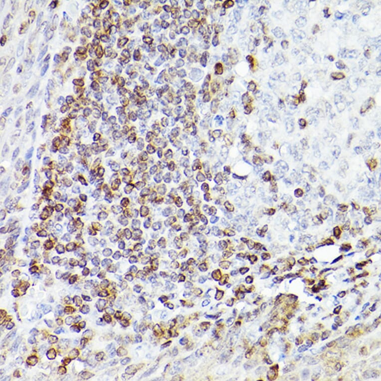 Immunohistochemistry - Anti-Bcl-2 Antibody [ARC0173] (A306910) - Antibodies.com