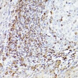 Immunohistochemistry - Anti-Bcl-2 Antibody [ARC0173] (A306910) - Antibodies.com