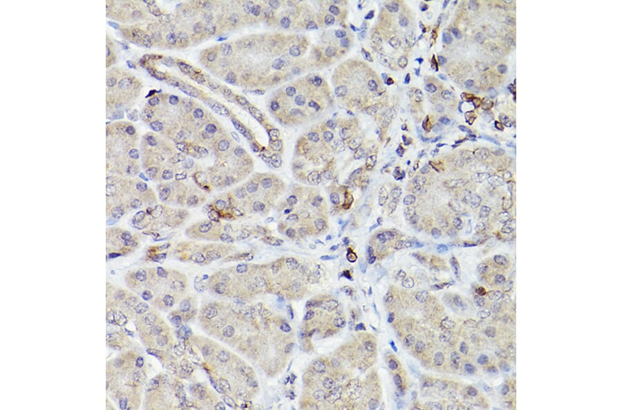 Immunohistochemistry - Anti-Bcl-2 Antibody [ARC0173] (A306910) - Antibodies.com