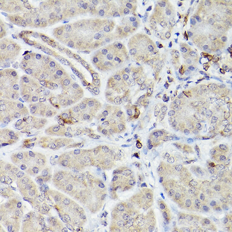 Immunohistochemistry - Anti-Bcl-2 Antibody [ARC0173] (A306910) - Antibodies.com