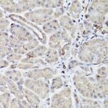 Immunohistochemistry - Anti-Bcl-2 Antibody [ARC0173] (A306910) - Antibodies.com