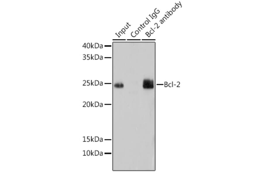 Western Blot - Anti-Bcl-2 Antibody [ARC0173] (A306910) - Antibodies.com