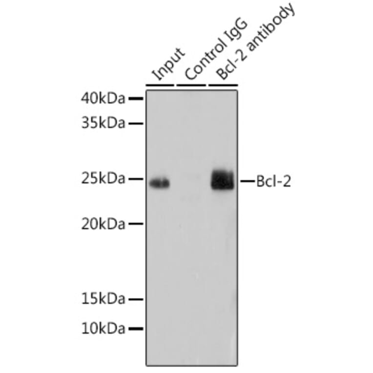 Western Blot - Anti-Bcl-2 Antibody [ARC0173] (A306910) - Antibodies.com