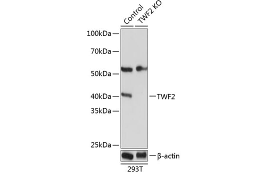 Western Blot - Anti-TWF2 Antibody (A306913) - Antibodies.com