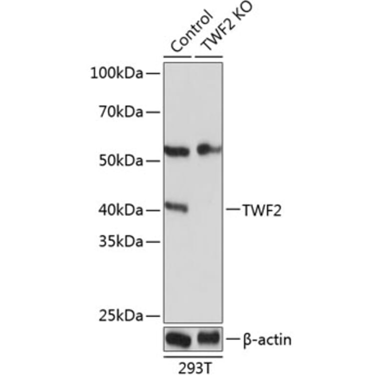 Western Blot - Anti-TWF2 Antibody (A306913) - Antibodies.com