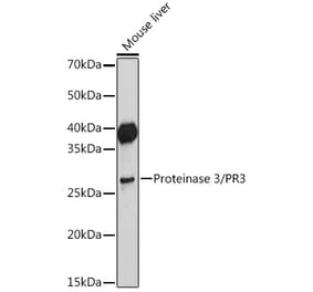 Western Blot - Anti-PR3 Antibody [ARC2275] (A306914) - Antibodies.com