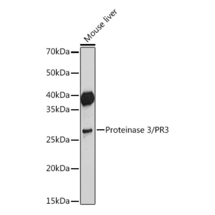 Western Blot - Anti-PR3 Antibody [ARC2275] (A306914) - Antibodies.com