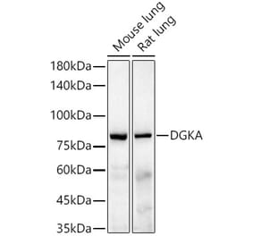 Western Blot - Anti-DGKA Antibody [ARC55777] (A306917) - Antibodies.com