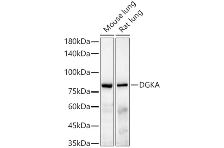 Western Blot - Anti-DGKA Antibody [ARC55777] (A306917) - Antibodies.com