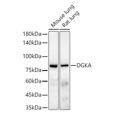 Western Blot - Anti-DGKA Antibody [ARC55777] (A306917) - Antibodies.com