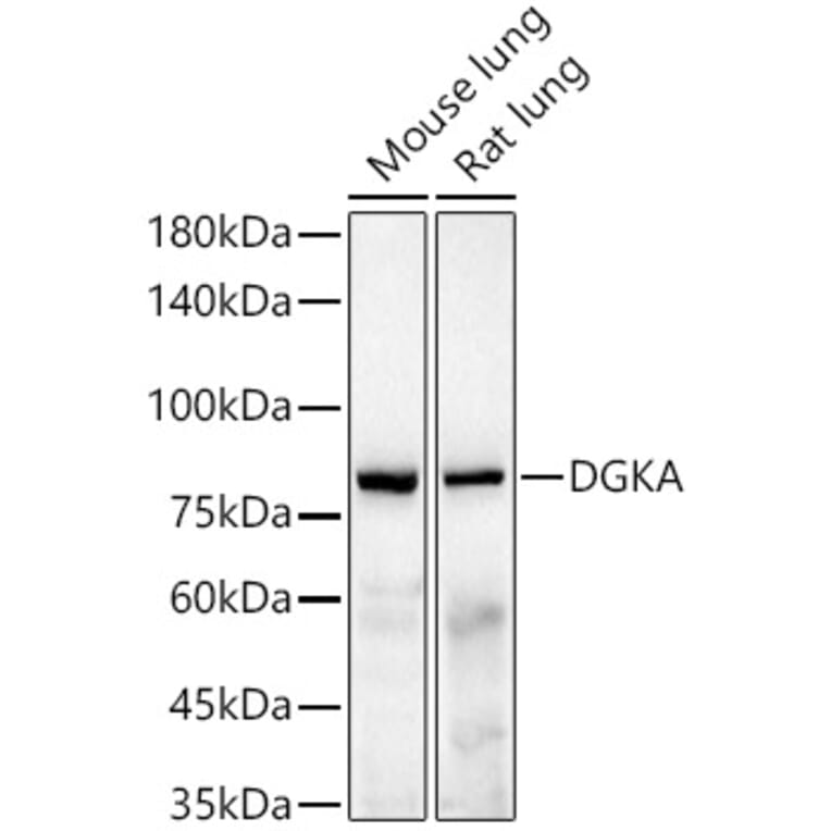 Western Blot - Anti-DGKA Antibody [ARC55777] (A306917) - Antibodies.com