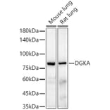 Western Blot - Anti-DGKA Antibody [ARC55777] (A306917) - Antibodies.com