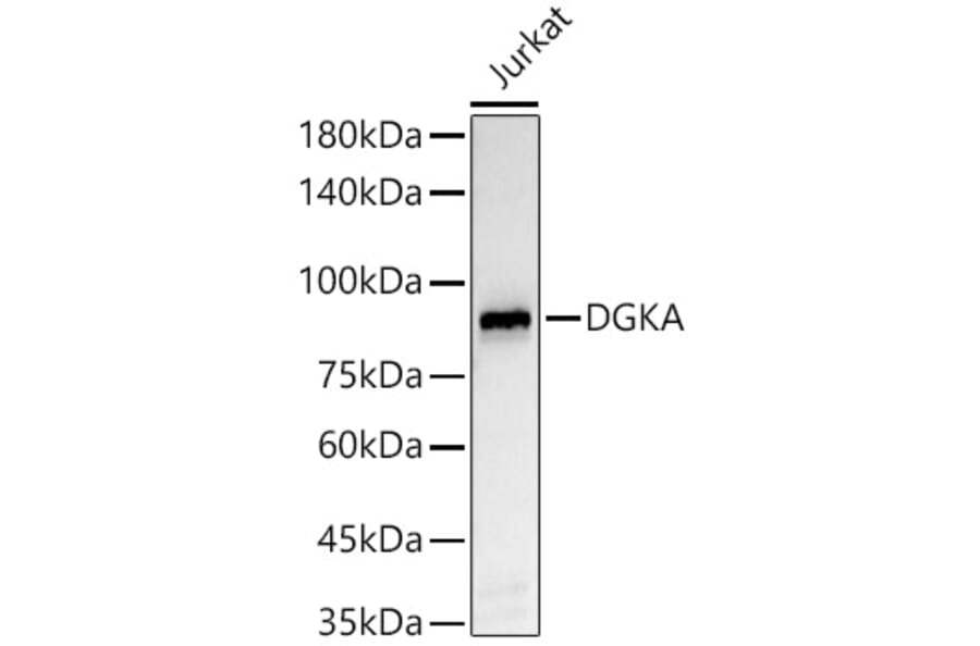 Western Blot - Anti-DGKA Antibody [ARC55777] (A306917) - Antibodies.com
