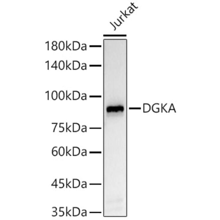 Western Blot - Anti-DGKA Antibody [ARC55777] (A306917) - Antibodies.com