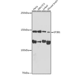 Western Blot - Anti-SF3B1 Antibody [ARC1724] (A306918) - Antibodies.com