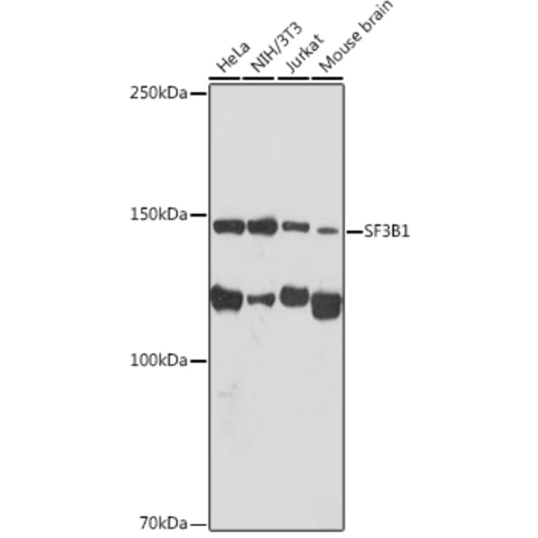 Western Blot - Anti-SF3B1 Antibody [ARC1724] (A306918) - Antibodies.com