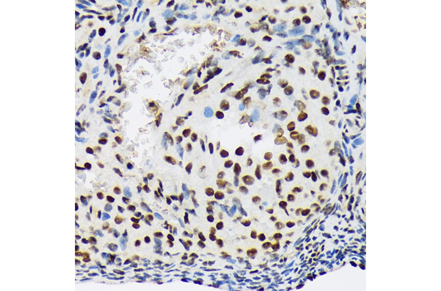 Immunohistochemistry - Anti-SF3B1 Antibody [ARC1724] (A306918) - Antibodies.com