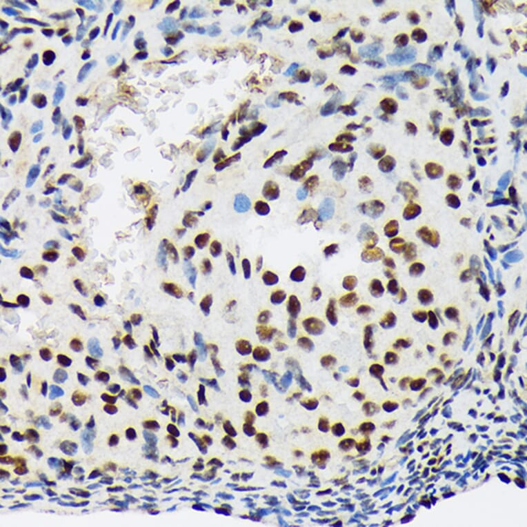 Immunohistochemistry - Anti-SF3B1 Antibody [ARC1724] (A306918) - Antibodies.com