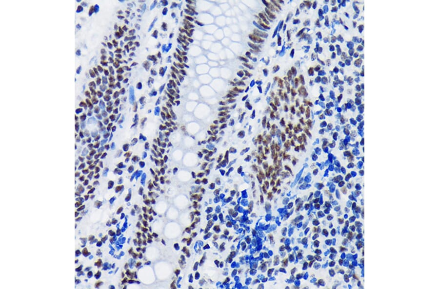 Immunohistochemistry - Anti-SF3B1 Antibody [ARC1724] (A306918) - Antibodies.com