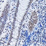 Immunohistochemistry - Anti-SF3B1 Antibody [ARC1724] (A306918) - Antibodies.com
