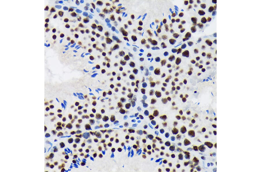 Immunohistochemistry - Anti-SF3B1 Antibody [ARC1724] (A306918) - Antibodies.com