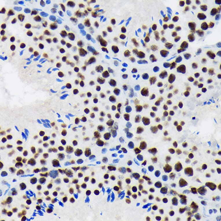 Immunohistochemistry - Anti-SF3B1 Antibody [ARC1724] (A306918) - Antibodies.com