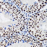 Immunohistochemistry - Anti-SF3B1 Antibody [ARC1724] (A306918) - Antibodies.com