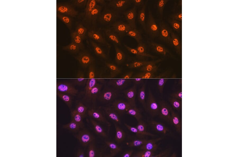 Immunofluorescence - Anti-SF3B1 Antibody [ARC1724] (A306918) - Antibodies.com