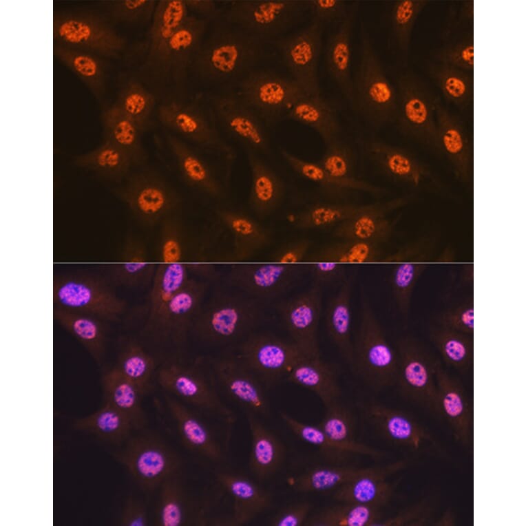 Immunofluorescence - Anti-SF3B1 Antibody [ARC1724] (A306918) - Antibodies.com