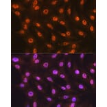 Immunofluorescence - Anti-SF3B1 Antibody [ARC1724] (A306918) - Antibodies.com