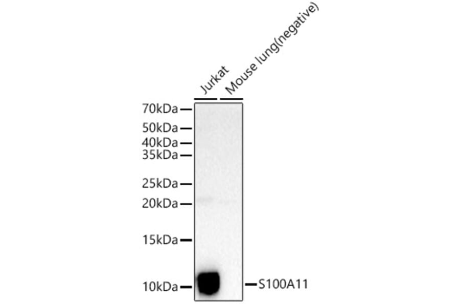 Western Blot - Anti-S100A11 Antibody (A306920) - Antibodies.com