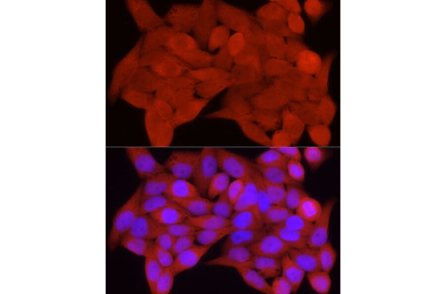 Immunofluorescence - Anti-S100A11 Antibody (A306920) - Antibodies.com