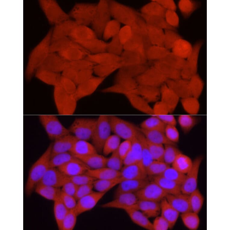 Immunofluorescence - Anti-S100A11 Antibody (A306920) - Antibodies.com