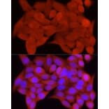 Immunofluorescence - Anti-S100A11 Antibody (A306920) - Antibodies.com