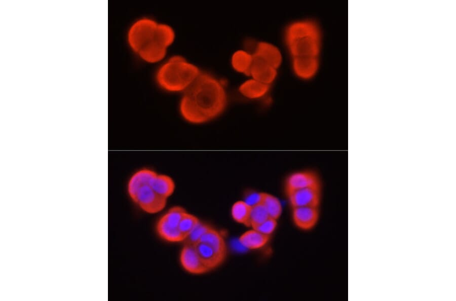 Immunofluorescence - Anti-S100A11 Antibody (A306920) - Antibodies.com