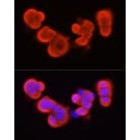 Immunofluorescence - Anti-S100A11 Antibody (A306920) - Antibodies.com